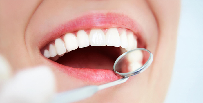 Dental Veneers – Brighten up your life